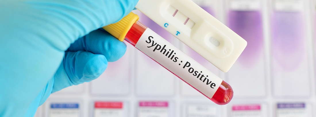 Тест на сифилис
