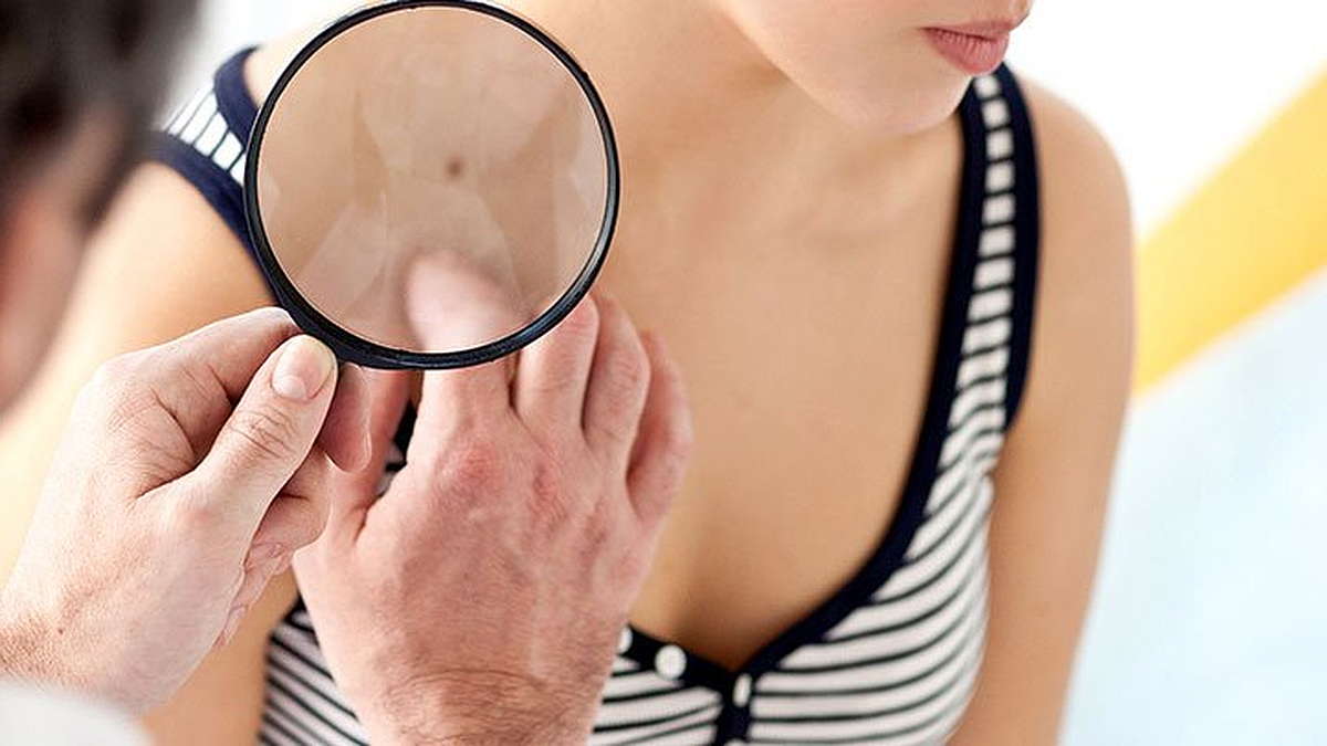 Признаки рака кожи дерматолог с лупой