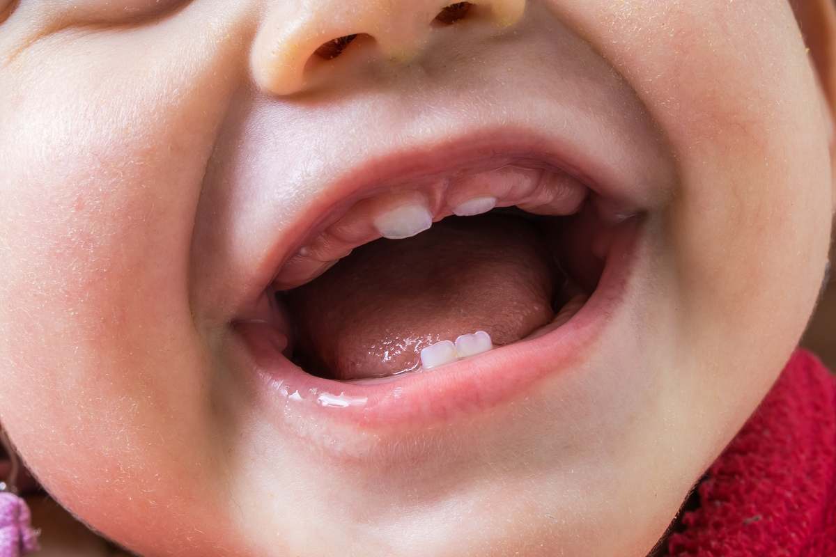 прорезывание зубов у детей