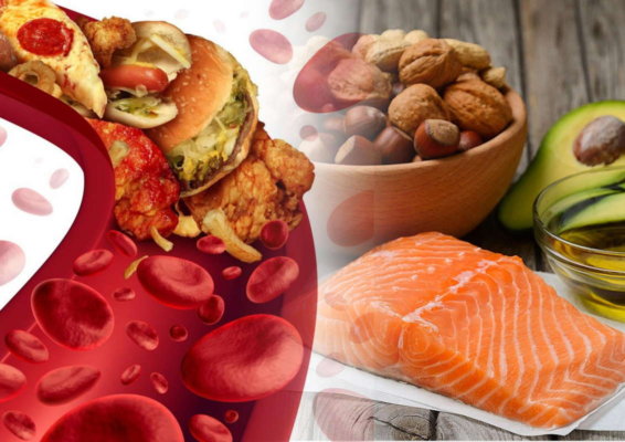 Правильное питание при повышенном холестерине – запрещённые и разрешённые продукты