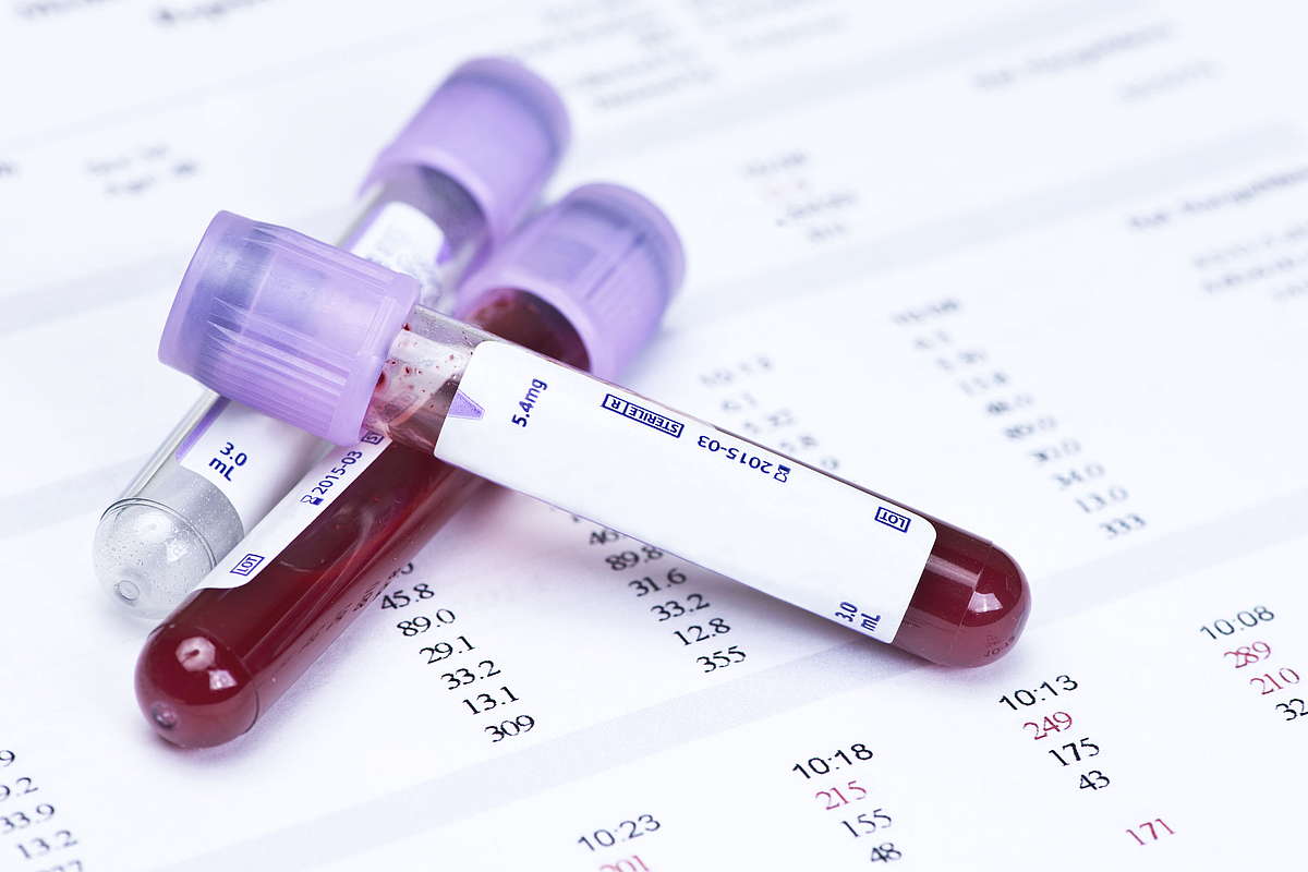 Сдача крови на анализ гормонов