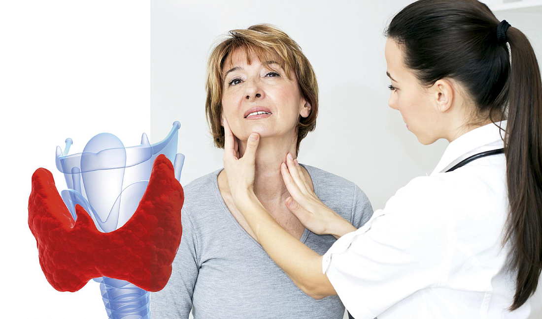 Лечение гипотиреоза щитовидной железы у женщин