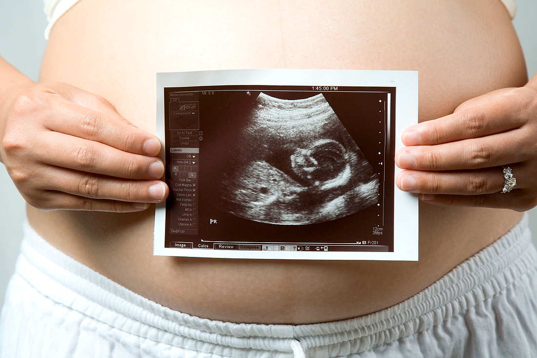 скрининг 1 триместра беременности снимок узи
